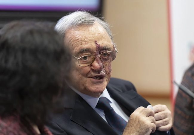 Inilunsad ang kampanya sa pangangalap ng pondo upang suportahan ang tagumpay ng Espanya sa pananaliksik sa kanser sa pancreatic