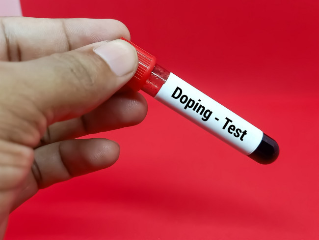 Ang mga pagsubok sa anti-doping ng Tour de France ay nagdulot ng mga reklamo sa pagitan ng mga rider at ilang mga akusasyon ng rigging