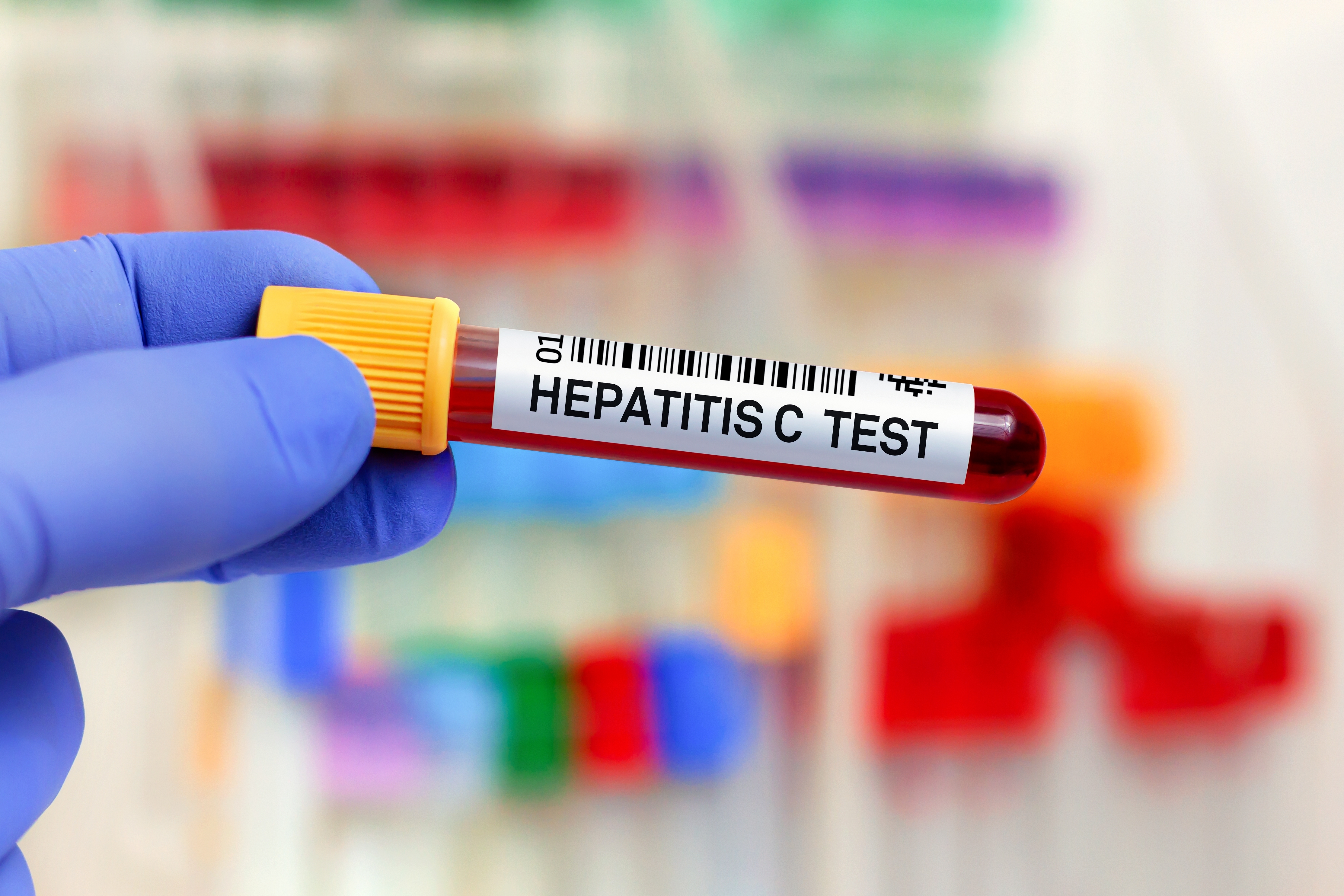 Ang England ay nasa landas upang maging isa sa mga unang bansa na mag-aalis ng hepatitis C
